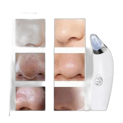 Extracteur de points noirs sous vide avec bouton incurvé