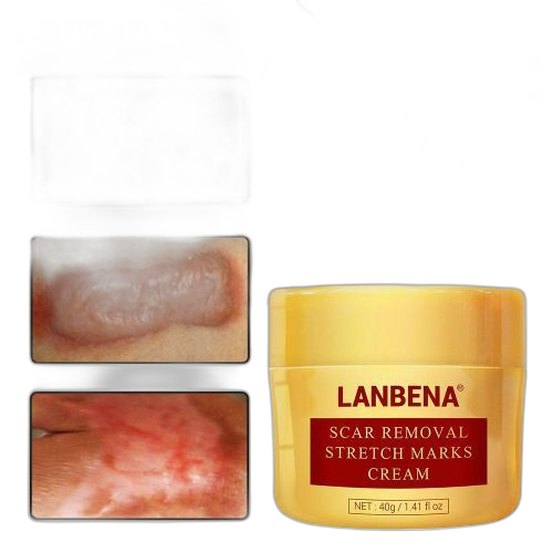 Lanbena crème soins de corps et beauté pour cicatrices et tâches