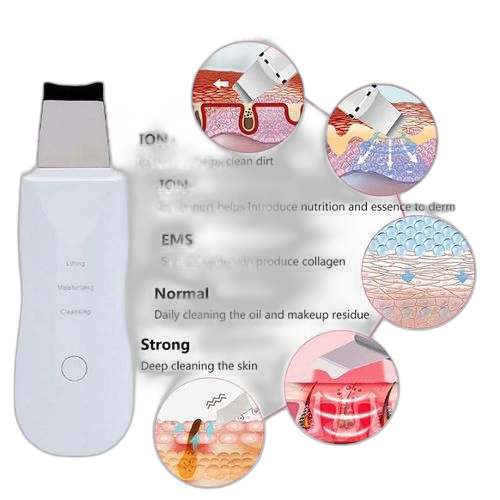 Nettoyeur de visage ultrasonique nettoyage en profondeur nettoyage des pores suppression des points noirs – Image 2