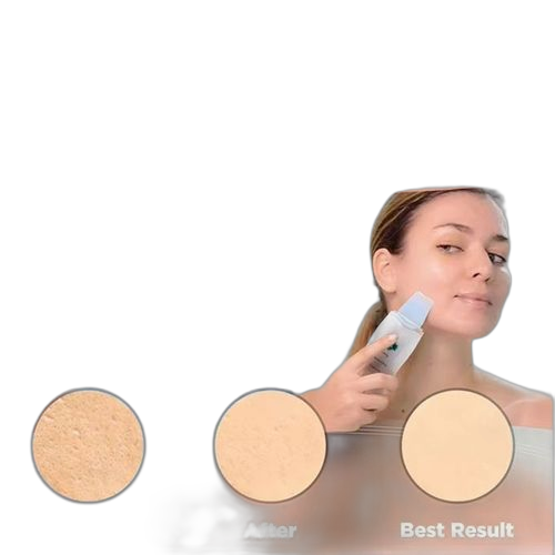 Nettoyeur de visage ultrasonique nettoyage en profondeur nettoyage des pores suppression des points noirs
