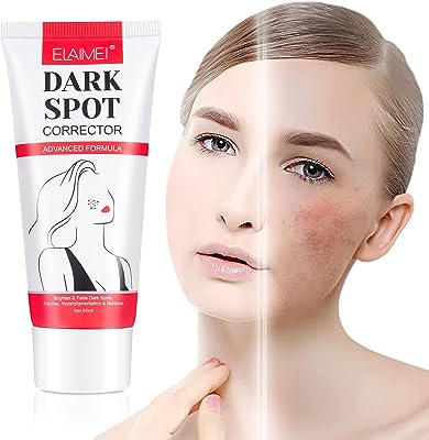 Crème correctrice de taches brunes sérum blanchissant anti âge pour le visage dissolvant rousseur et mélasma. Ne cherchez plus ailleurs, DIAYTAR SENEGAL  est là pour vous offrir des produits à prix cassés. Parcourez notre boutique en ligne et découvrez notre large sélection de produits allant de la maison à l'électroménager, de l'informatique à la mode. Profitez de nos prix discount exceptionnels pour réaliser de grandes économies.