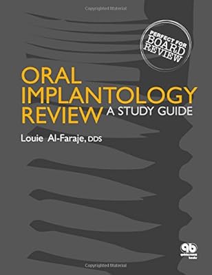 Revue d'implantologie orale : un guide d'étude