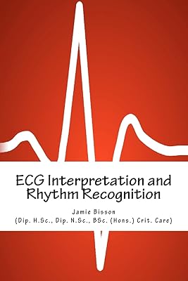Interprétation ecg et reconnaissance du rythme
