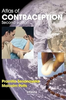 Atlas de la contraception