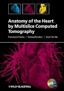 Anatomie du cœur par tomodensitométrie multicoupes
