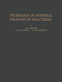 Technique de fixation interne des fractures