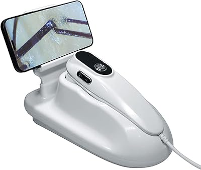 Analyseur de cheveux de diagnostic de peau, loupe d'analyse de test de détection