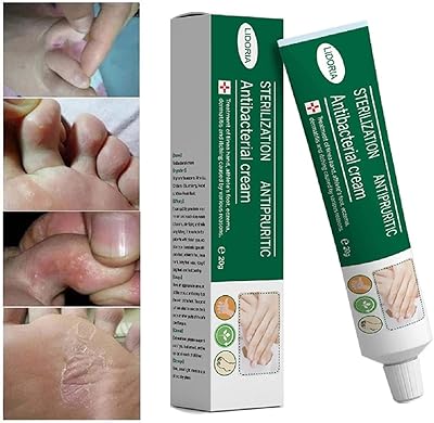 Crème antifongique pour les mains et les pieds 20 grammes pour soulager