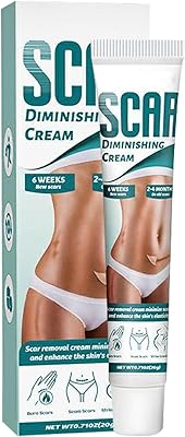 Crème anti-vergetures 4 pièces | 20g de gel éclaircissant à base de plantes