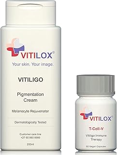 Vitiligo vitilox® crème de pigmentation et capsules d'immunothérapie t-cell-v