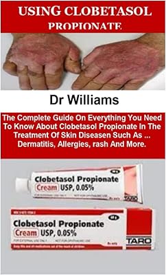Utilisation du propionate de clobetasol : le guide complet sur tout ce que