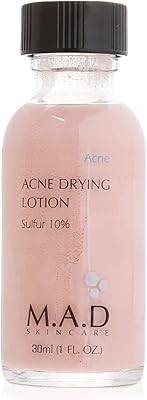 Mad skin care lotion asséchante contre l'acné, 30 ml (1 fl oz)