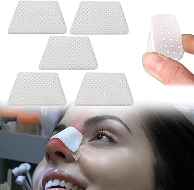 Attelles nasales thermoplastiques, protecteur de support nasal externe pour fractures nasales, ostéoplastie