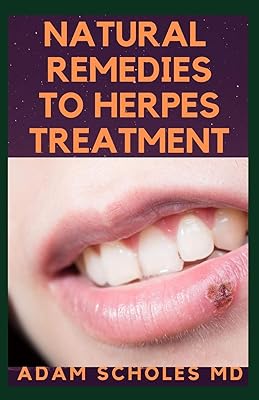Remèdes naturels pour le traitement de l'herpès : le guide complet sur le traitement