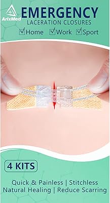 Dispositif de fermeture d'urgence des plaies kit de suture à éclair 4
