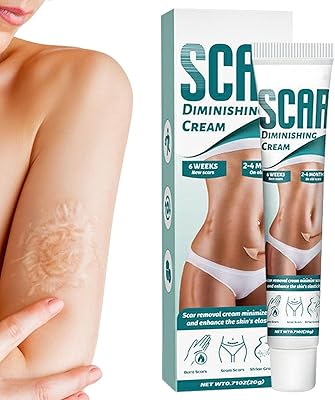 Crème réparatrice de cicatrices 3 pièces - crème dissolvante naturelle pour cicatrice |