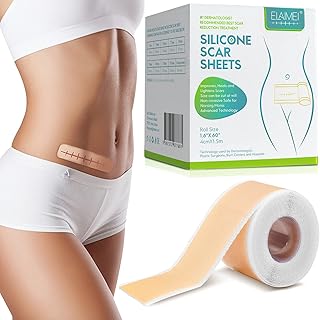 Papiers de cicatrice en silicone, papiers de cicatrice en silicone professionnels pour l'élimination