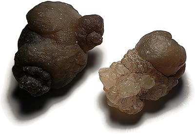 Ensemble de 2 pièces de calcédoine botryoïdale brute, alias agate à bulles, 23