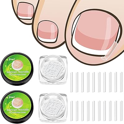 Bandes de correction des ongles incarnés patchs incurvés clips de récupération incarnés outil