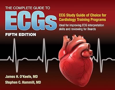 Le guide complet des ecg : un d'étude pour améliorer les compétences