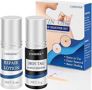 Dissolvant cosmétique d'acrochordons, ensemble de lotion d'élimination et de réparation des acrochordons, dissolvant