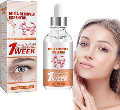 3pcs speedy milia remover, milia remover milia spot treatment, aide à dissoudre