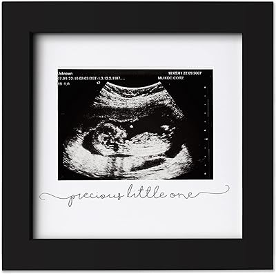 Cadre photo échographie pour bébé moderne pour future maman cadres annonce de grossesse