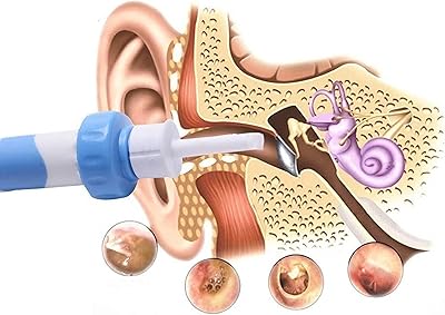 Kit de nettoyage électrique des oreilles pour l'élimination du cérumen, aspiration automatique à