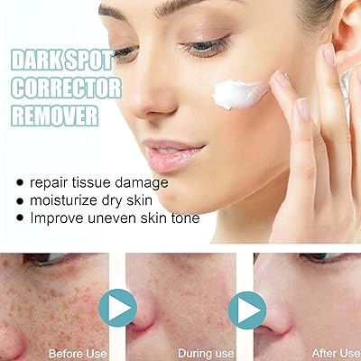 T.o.g. dissolvant correcteur de taches brunes melasma réduit les taches de vieillesse anti-âge