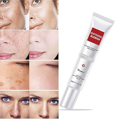 Dissolvant de taches brunes pour le visage, résultats instantanés, crème d'élimination des taches