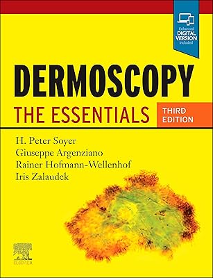 Dermoscopie : les essentiels